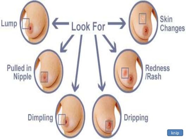 signs of breast cancer in females Mature girls getting fucked
